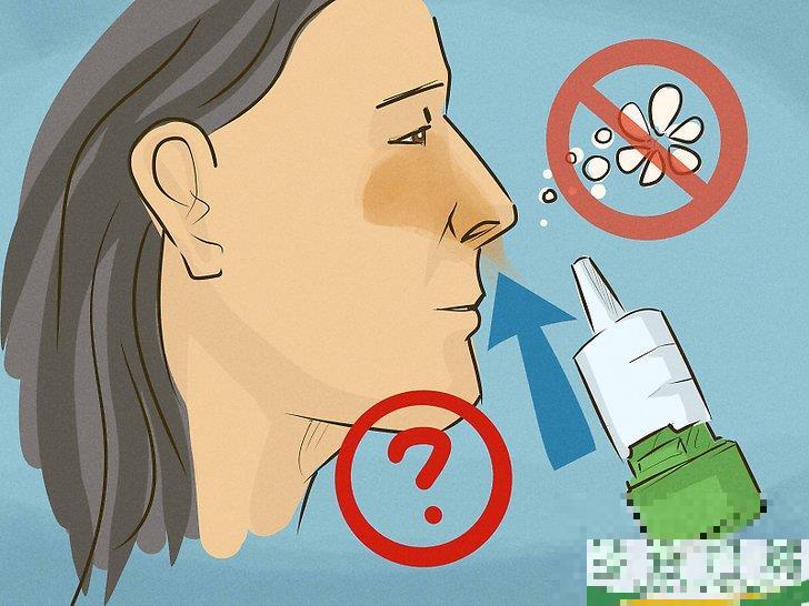 怎么在使用Flonase喷雾剂（丙酸氟替卡松）时避免副作用(丙酸氟替卡松鼻喷雾剂副作用该怎么消除)
